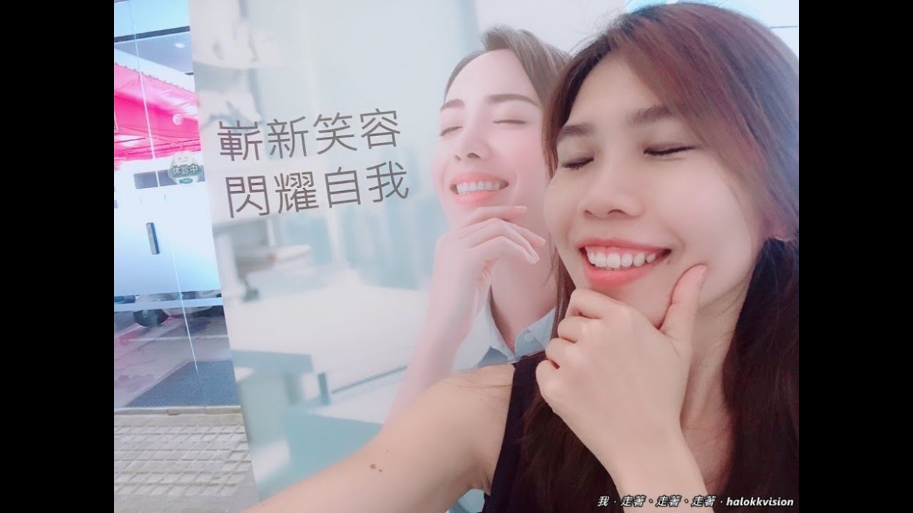 台中牙醫推薦｜西屯區:寬庭牙醫診所，冷光美白牙齒，讓你自信笑得更燦爛!(前後差異,服務流程,療程費用,診所環境)